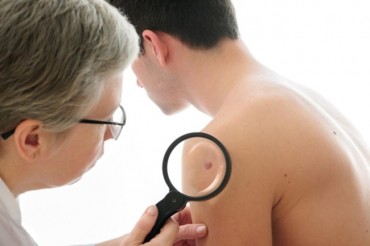 Skin Cancer Cases Grow some 40 % in Recent Years